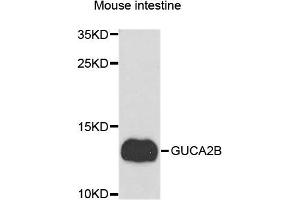 Western blot analysis of extracts of Mouse intestine cells, using GUCA2B antibody. (GUCA2B anticorps)