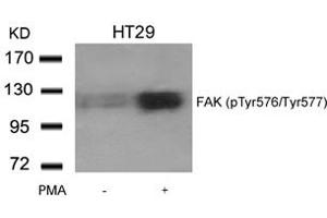 Image no. 2 for anti-PTK2 Protein tyrosine Kinase 2 (PTK2) (pTyr576), (pTyr577) antibody (ABIN401608) (FAK anticorps  (pTyr576, pTyr577))