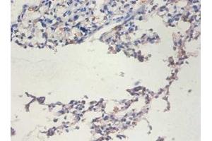 Immunohistochemistry of paraffin-embedded human lung tissue using ABIN7171713 at dilution of 1:100