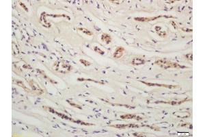 Formalin-fixed and paraffin embedded human kidney labeled with Rabbit Anti-YES1 Polyclonal Antibody, Unconjugated  at 1:200 followed by conjugation to the secondary antibody and DAB staining (YES1 anticorps  (AA 441-541))