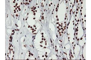 Immunohistochemical staining of paraffin-embedded Human Kidney tissue using anti-GSTT2 mouse monoclonal antibody. (GSTT2 anticorps)
