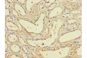 Immunohistochemistry of paraffin-embedded human kidney tissue using ABIN7158679 at dilution of 1:100 (BRCC3 anticorps  (AA 14-316))
