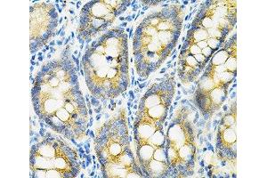 Immunohistochemistry of paraffin-embedded Rat intestine using HGF Polyclonal Antibody at dilution of 1:100 (40x lens). (HGF anticorps)