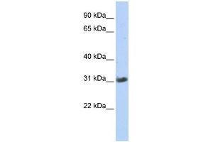 WB Suggested Anti-ZFAND3 Antibody Titration:  0. (ZFAND3 anticorps  (Middle Region))