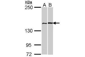 WB Image Sample (30 ug of whole cell lysate) A: A431 , B: Hela 12% SDS PAGE antibody diluted at 1:1000 (FANCA anticorps  (N-Term))