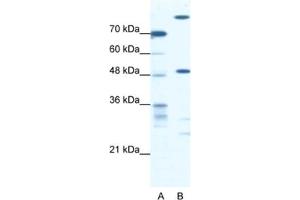 Western Blotting (WB) image for anti-NFS1, Cysteine Desulfurase (NFS1) antibody (ABIN2460657) (NFS1 anticorps)