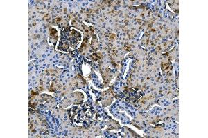 IHC analysis of ASS1 using anti-ASS1 antibody (ABIN7601191).