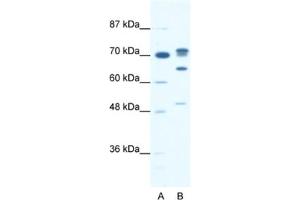 Western Blotting (WB) image for anti-DEAD (Asp-Glu-Ala-Asp) Box Polypeptide 21 (DDX21) antibody (ABIN2461343) (DDX21 anticorps)