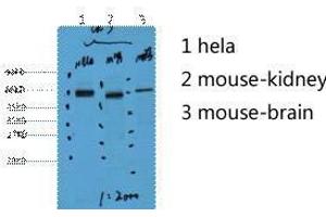 Western Blot (WB) analysis of 1) HeLa, 2) Mouse Kidney, 3) Mouse Brain, diluted at 1:2000. (Cytokeratin 7 anticorps)
