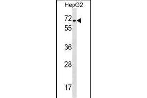 Western blot analysis in HepG2 cell line lysates (35ug/lane). (CACNB1 anticorps  (C-Term))