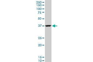 GOT2 polyclonal antibody (A01), Lot # FHC0061120QCS1.