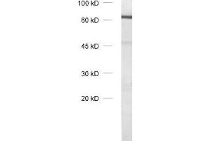 dilution: 1 : 1000, sample: olfactory bulb homogenate (Tyrosine Hydroxylase anticorps)