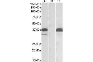 HEK293 lysate (10ug protein in RIPA buffer) overexpressing Human PIM2 with C-terminal MYC tag probed with ABIN1590101 (0.