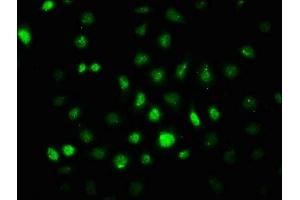 Immunofluorescence staining of A549 cells with ABIN7127692 at 1:100,counter-stained with DAPI. (Recombinant PRKAA2 anticorps  (pThr172))