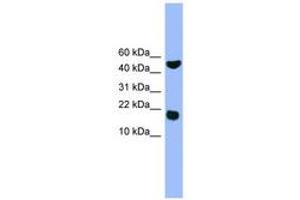 Image no. 1 for anti-RWD Domain Containing 1 (RWDD1) (AA 41-90) antibody (ABIN6746575) (RWDD1 anticorps  (AA 41-90))
