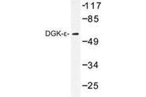 Western blot analysis of DGK-ε antibody in extracts from K562 cells. (DGKE anticorps)