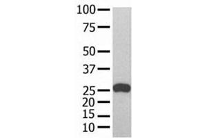 GST Tag antibody used in western blot with recombinant protein (GST-Tag anticorps)
