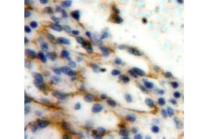 Used in DAB staining on fromalin fixed paraffin-embedded Spleen tissue (P-Selectin anticorps  (AA 58-195))