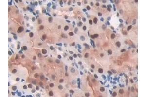 Detection of TALDO1 in Mouse Kidney Tissue using Polyclonal Antibody to Transaldolase (TALDO1)