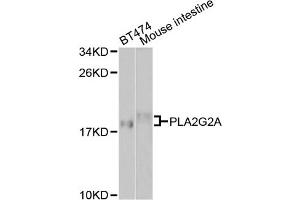 Western blot analysis of extracts of various cell lines, using PLA2G2A antibody. (PLA2G2A anticorps)