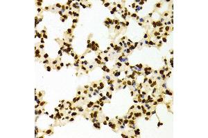 Immunohistochemistry of paraffin-embedded Mouse lung using H3K27me2 antibody at dilution of 1:100 (x400 lens).