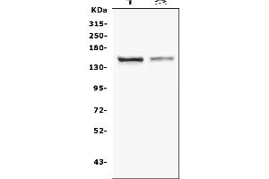 Western blot analysis of CRB1 using anti-CRB1 antibody (ABIN6719658). (CRB1 anticorps)