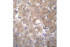 Formalin fixed, paraffin embedded human liver tissue stained with SIX5 Antibody  followed by peroxidase conjugation of the secondary antibody and DAB staining.