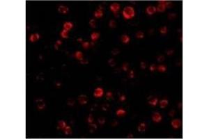 Immunofluorescence of RAIDD in Hela cells with RAIDD antibody at 20 µg/ml. (CRADD anticorps  (Middle Region))