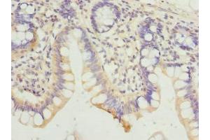 Immunohistochemistry of paraffin-embedded human small intestine tissue using ABIN7154822 at dilution of 1:100