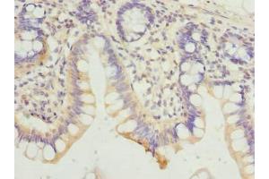Immunohistochemistry of paraffin-embedded human small intestine tissue using ABIN7154822 at dilution of 1:100 (HDHD3 anticorps  (AA 1-251))