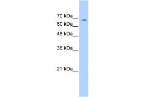 WB Suggested Anti-GP1BA Antibody Titration:  0. (CD42b anticorps  (C-Term))