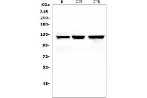 Western blot analysis of NLRP2 using anti-NLRP2 antibody (ABIN6719345). (NLRP2 anticorps  (AA 9-190))