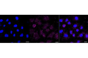 anti-Golgi-Associated PDZ and Coiled-Coil Motif Containing (GOPC) antibody