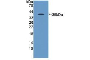 Detection of Recombinant Protein RPA096Ca01 with GST-tag using Anti-Glutathione S Transferase (GST) Tag Polyclonal Antibody (GST anticorps  (AA 1-218))