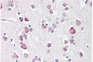 anti-Neurogenin 2 (NEUROG2) (C-Term) antibody