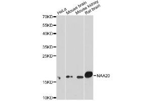 Western blot analysis of extracts of various cell lines, using NAA20 antibody. (NAT5 anticorps)