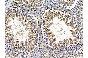 ABIN6256995 and ABIN6274348 at 1/100 staining rat testis tissue by IHC-P.