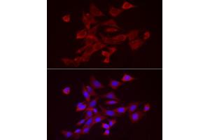 Immunofluorescence analysis of NIH/3T3 cells using  Rabbit pAb (ABIN7265439) at dilution of 1:25 (40x lens). (ADAMTS1 anticorps  (AA 718-967))