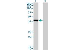 Western Blot analysis of SMS expression in transfected 293T cell line by SMS monoclonal antibody (M01), clone 1G6. (SMS anticorps  (AA 1-366))