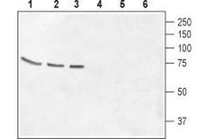 Western blot analysis of rat brain membrane (lanes 1 and 4), mouse brain membrane (lanes 2 and 5) and Human CCF-STGI  brain astrocytoma cell lysate (lanes 3 and 6): - 1-3. (GABRQ anticorps  (Extracellular, N-Term))