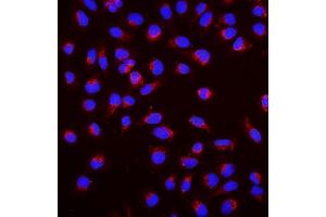 IF analysis of SGK1 using anti-SGK1 antibody (ABIN7603118). (SGK1 anticorps  (N-Term))