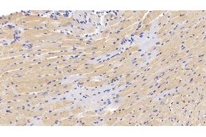 Detection of MUC5AC in Mouse Cardiac Muscle Tissue using Polyclonal Antibody to Mucin 5 Subtype AC (MUC5AC) (MUC5AC anticorps  (AA 430-549))