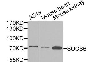 Western blot analysis of extracts of various cells, using SOCS6 antibody. (SOCS6 anticorps)