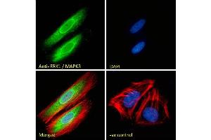 ABIN185399 Immunofluorescence analysis of paraformaldehyde fixed HeLa cells, permeabilized with 0.