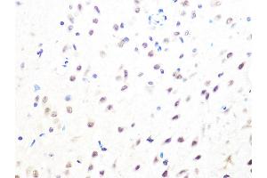 Immunohistochemistry of paraffin-embedded rat brain using MB/MB/ML2 Rabbit mAb (ABIN1679325, ABIN3019109, ABIN3019110 and ABIN7101716) at dilution of 1:100 (40x lens).