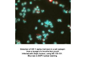 Image no. 4 for anti-Hypoxia Inducible Factor 1, alpha Subunit (Basic Helix-Loop-Helix Transcription Factor) (HIF1A) (AA 329-530) antibody (ABIN363210)