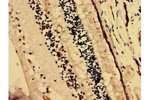 anti-Crystallin, beta A4 (CRYbA4) (AA 2-196) antibody