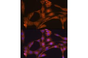 Immunofluorescence analysis of NIH-3T3 cells using CLOCK Rabbit mAb (ABIN7266414) at dilution of 1:100 (40x lens). (CLOCK anticorps)