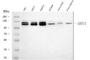 Western blot analysis of SART1 using anti-SART1 antibody (ABIN7599884).