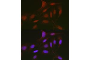 anti-Retinoblastoma-Like 2 (p130) (RBL2) (AA 100-200) antibody